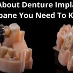 Facts About Denture Implants in Brisbane You Need To Know Before Getting One